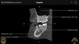 cbct problems & solutions and troubleshooting guide - 1