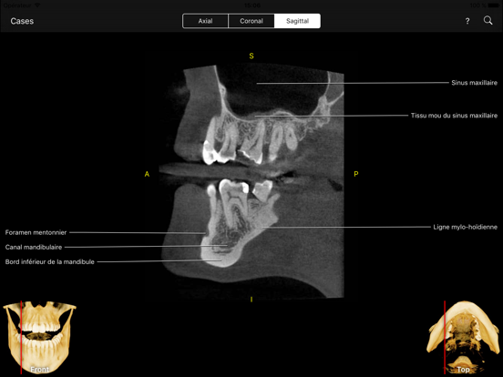 Screenshot #6 pour CBCT