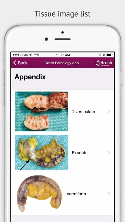 Gross Pathology screenshot-4