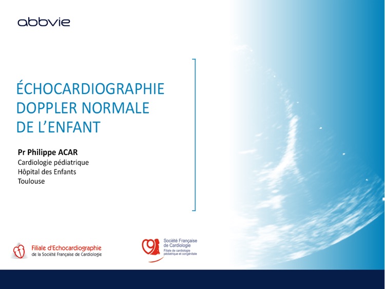 Echocardiographie chez l'enfant