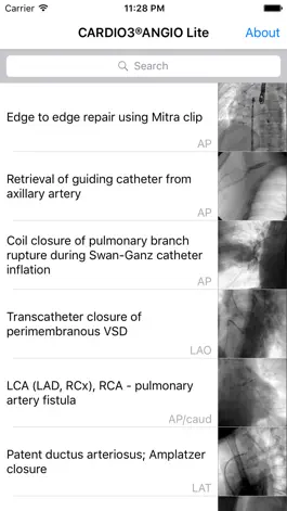 Game screenshot CARDIO3® Atlas of Interventional Cardiology – Lite apk