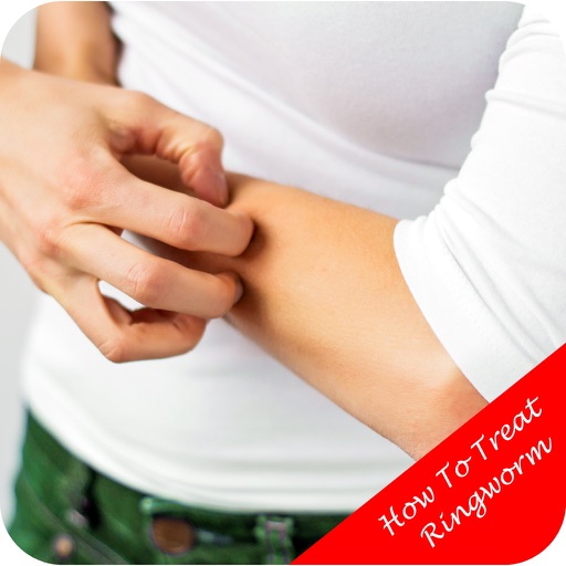 How To Treat Ringworm Tips and Suggestions by Gary O Brien