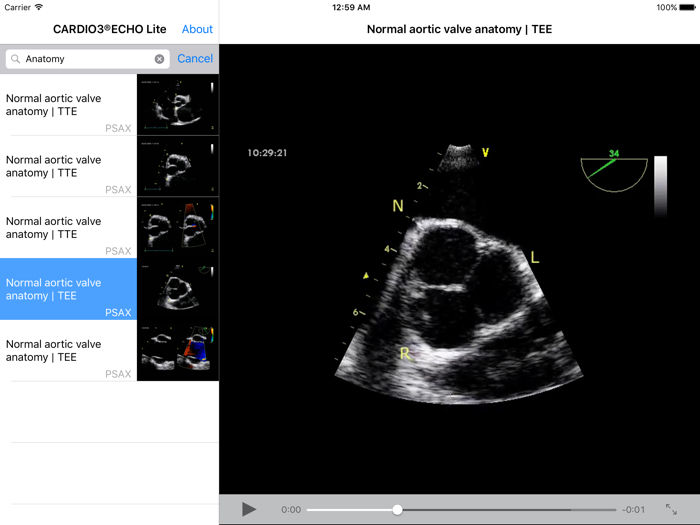 CARDIO3® Comprehensive Atlas of Echocardiography - Lite