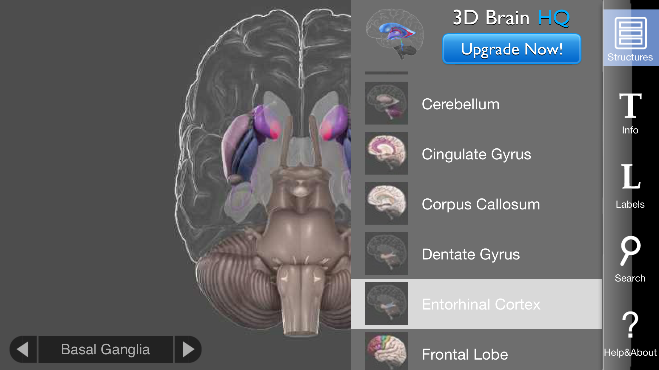 3D Brain