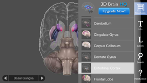 3D Brain screenshot