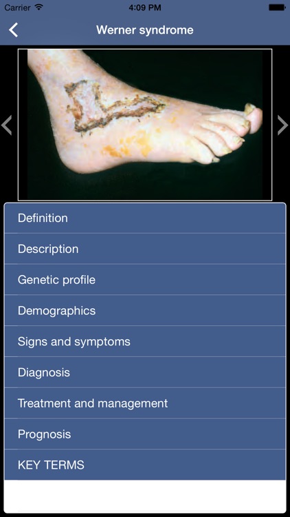 Genetic Disorders and Syndromes Pocket screenshot-4