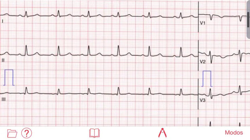Photo EKG screenshot 1 of 4