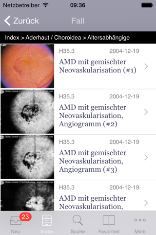 Atlas of Ophthalmology screenshot 2