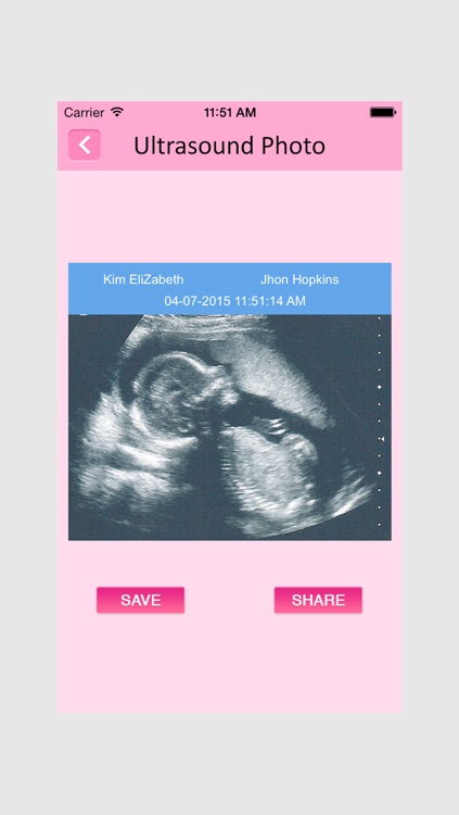 Ultrasound Spoof - Pregnancy Prank App
