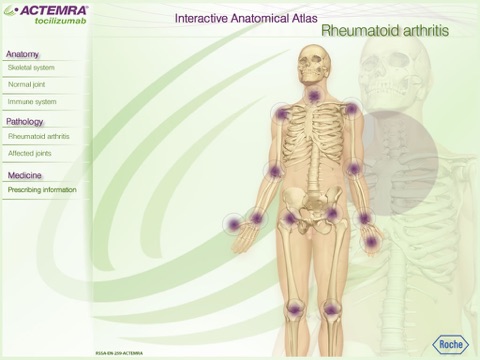 Rheumatoid Arthritis Atlas screenshot 4