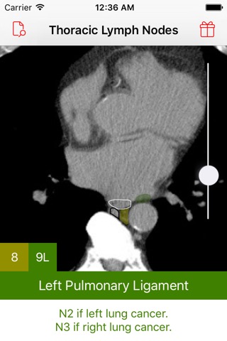 Thoracic Lymph Node Mapのおすすめ画像4