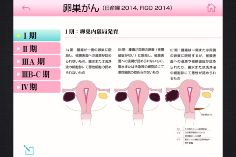 専門医の医学図典　婦人科手術 screenshot 4
