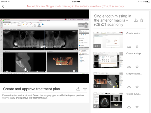 Screenshot #4 pour NobelClinician® Tutorial