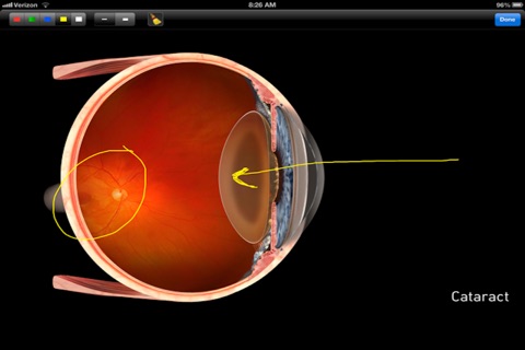 Sight Selector Subscription screenshot 3