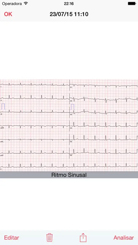 Photo EKG screenshot 4 of 4