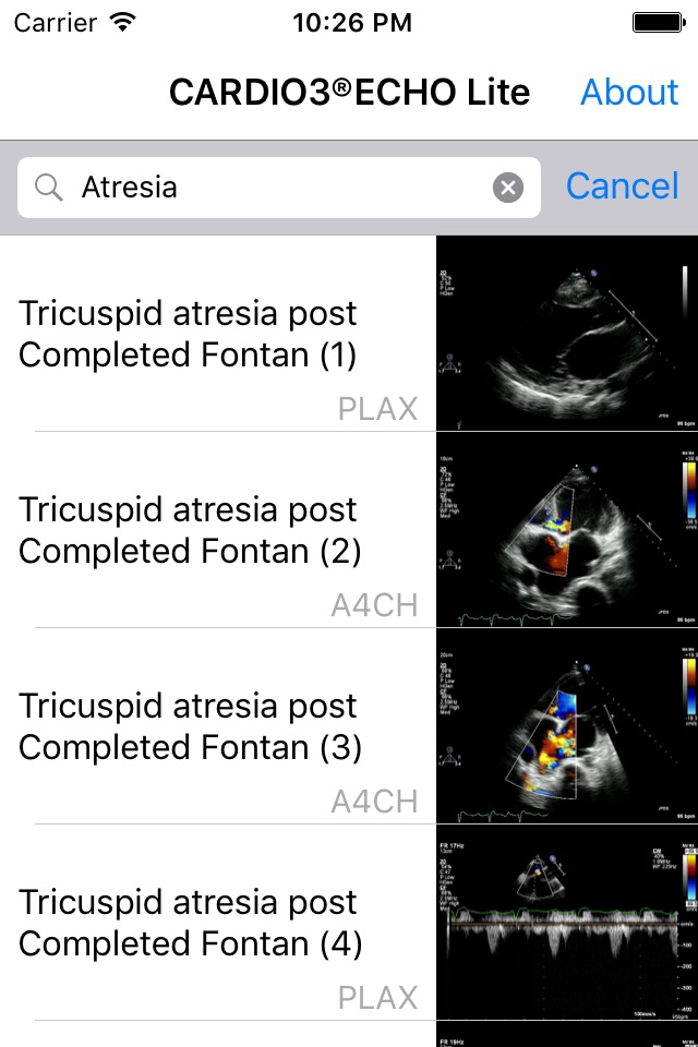 CARDIO3® Comprehensive Atlas of Echocardiography - Lite screenshot 3