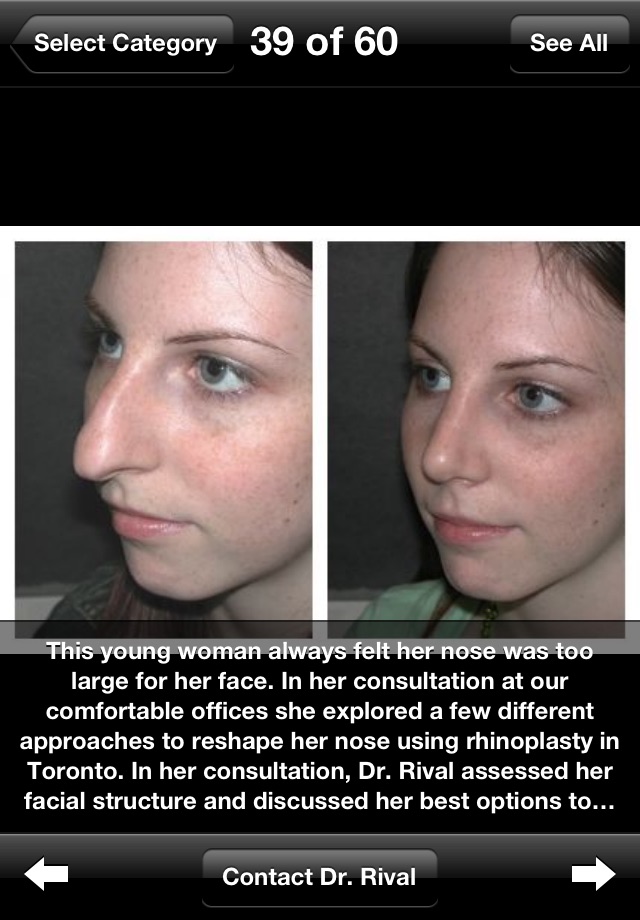 Toronto Facial Plastic Surgery with Dr. Rival screenshot 2