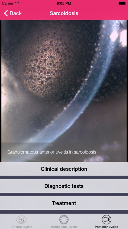 Uveitis doctor screenshot-3