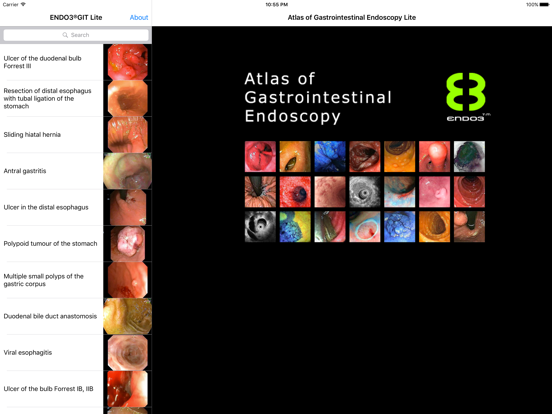 Screenshot #4 pour ENDO3® Atlas of Gastrointestinal Endoscopy - Lite