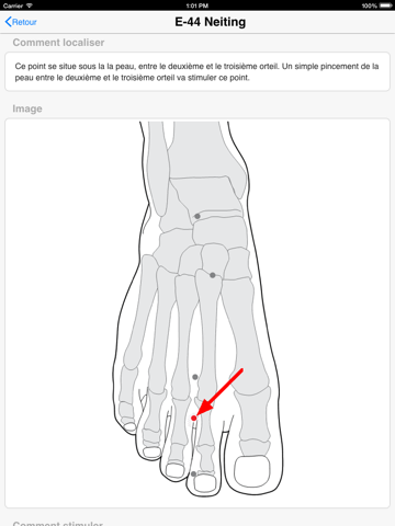 Screenshot #6 pour L'acupressure: Maux de tête