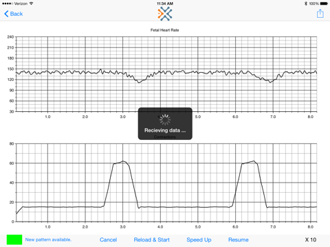 Simulated Electronic Fetal Monitor screenshot 4