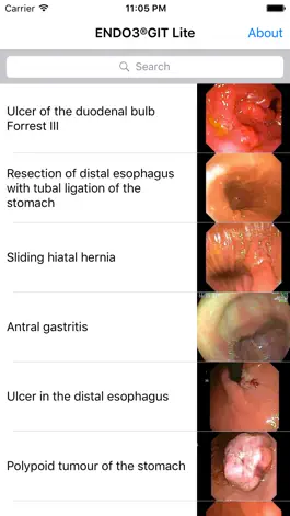 Game screenshot ENDO3® Atlas of Gastrointestinal Endoscopy - Lite apk
