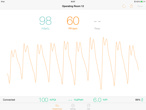 Screenshot #4 pour PulseOximeter