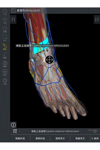 3DBody骨科 screenshot 4