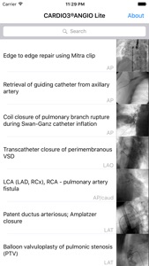 CARDIO3® Atlas of Interventional Cardiology – Lite screenshot #2 for iPhone