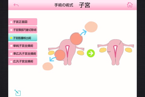 専門医の医学図典　婦人科手術 screenshot 2