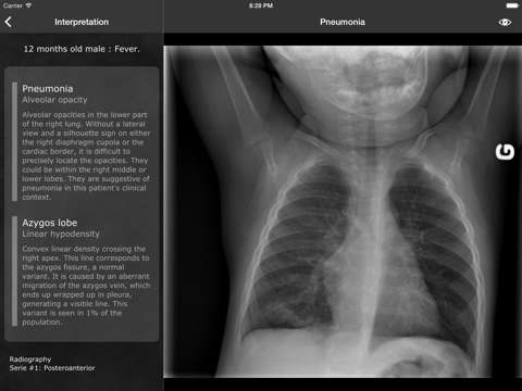 RealWorld Radiologyのおすすめ画像3