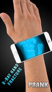 Simulator X-Ray Hand Fracture screenshot #1 for iPhone