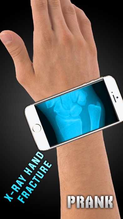Screenshot #1 pour Simulator X-Ray Hand Fracture
