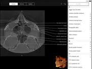 cbct ipad resimleri 4