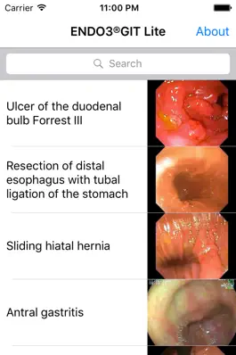 Game screenshot ENDO3® Atlas of Gastrointestinal Endoscopy - Lite apk