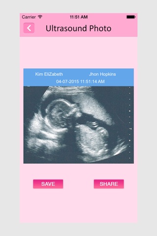 Ultrasound Spoof - Pregnancy Prank App screenshot 2