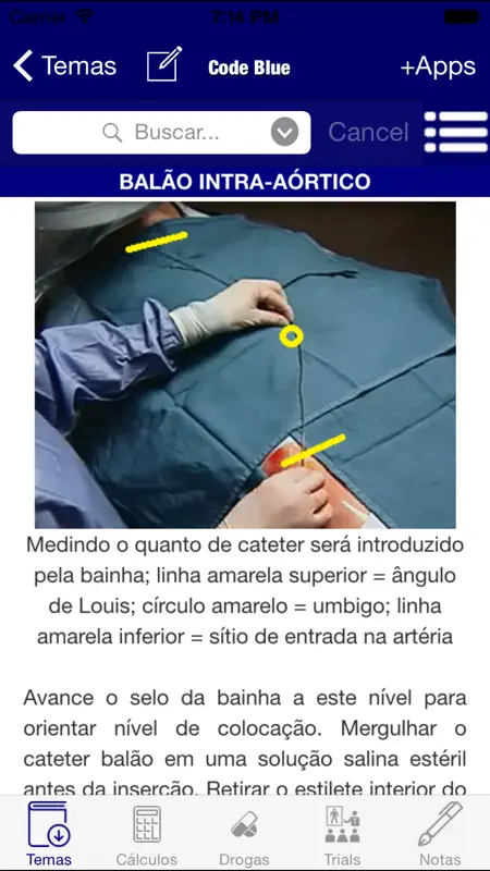 Guia de CTI - Code Blue - Medicina Intensiva, emergência, terapia intensiva, cuidado intensivo, cti, uti, emergencia screenshot 2 of 5