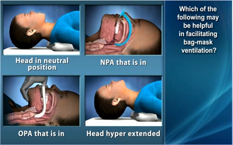 Medrills: Pediatric Airway screenshot 2