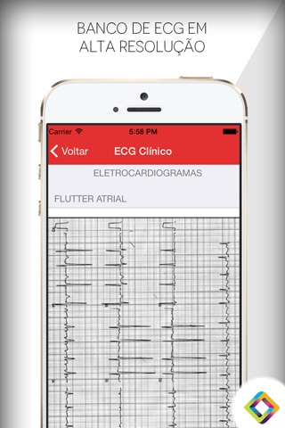 ECG Clínico: Guia de eletrocardiograma screenshot 2