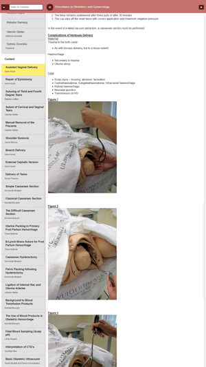 Procedures in O&G(圖2)-速報App