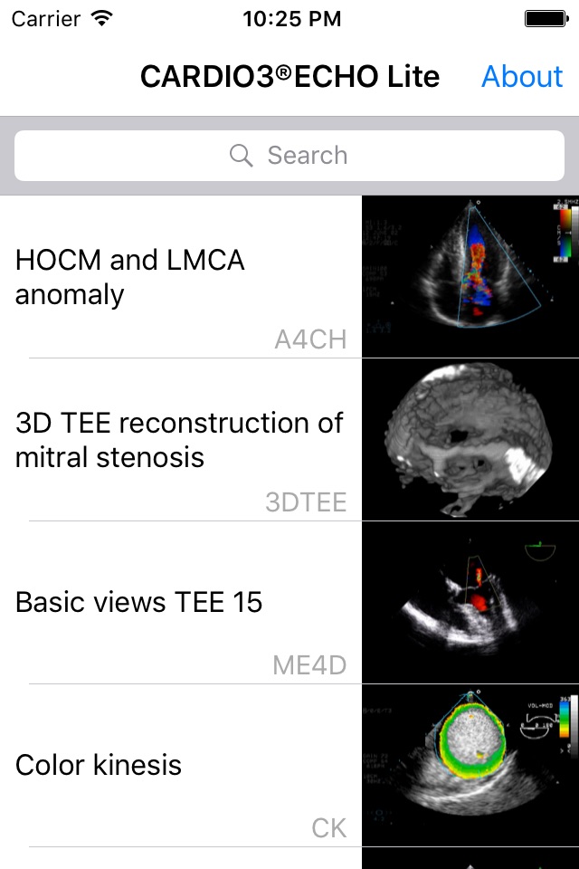 CARDIO3® Comprehensive Atlas of Echocardiography - Lite screenshot 2