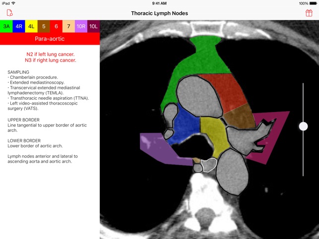 Thoracic Lymph Nodes