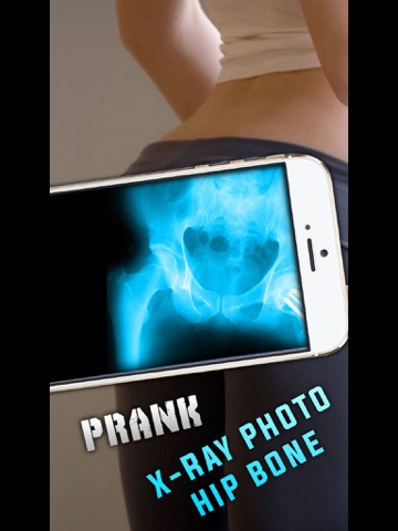 Simulator X-Ray Photo Hip Bone