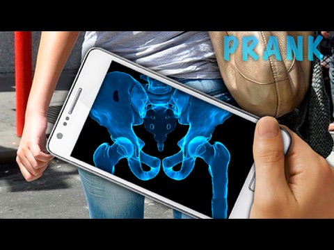 Screenshot #5 pour Simulator X-Ray Hip Bone
