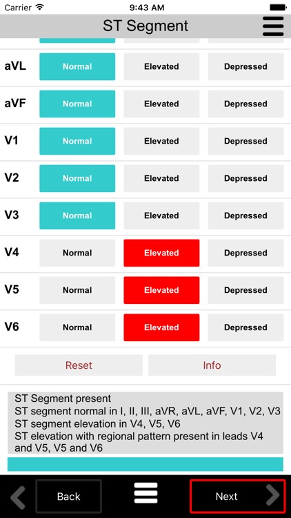 Ecg Calc