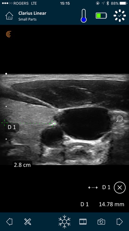 Clarius Ultrasound App screenshot-3
