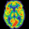 Radiology Core: Nuclear Medicine - iPadアプリ