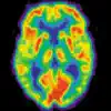 Radiology Core: Nuclear Medicine Positive Reviews, comments