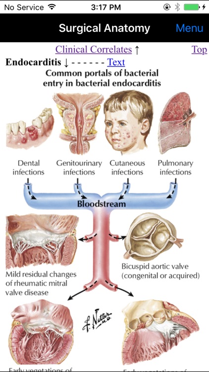 Netter's Surgical Anatomy Review P.R.N. screenshot-4