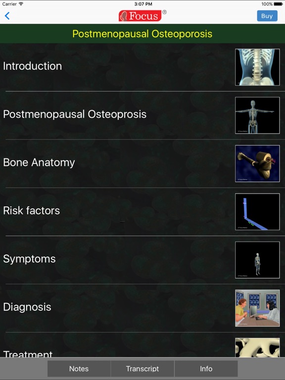 Screenshot #6 pour Orthopaedics - Understanding Disease